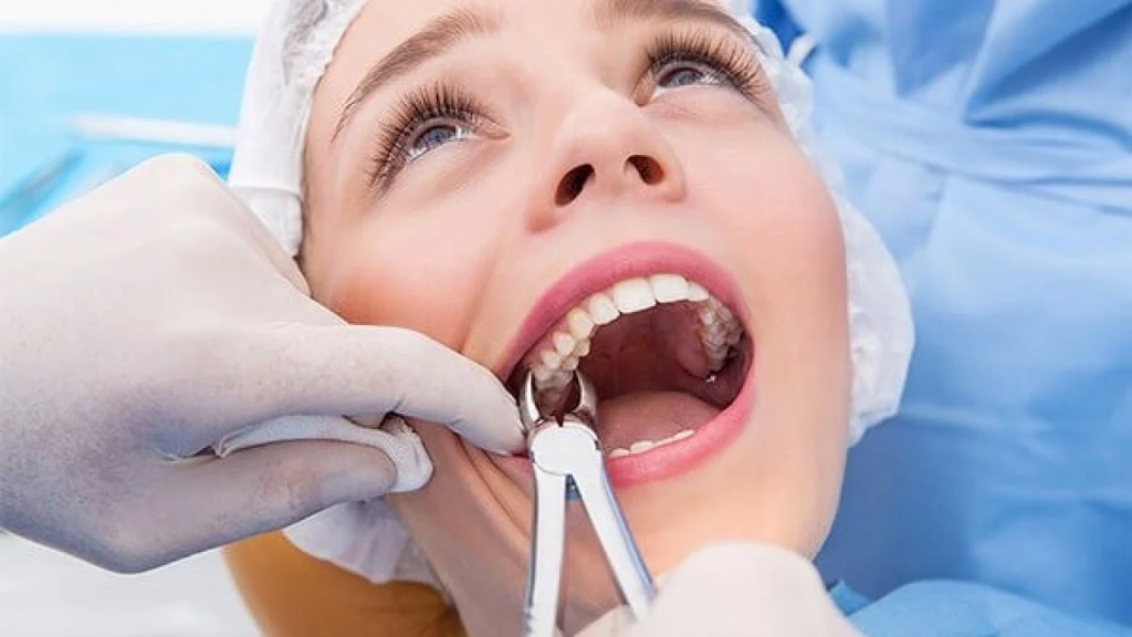 cabut_gigi_arini_dental_care