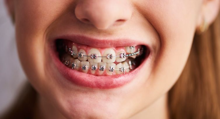 bentuk_wajah_ortho