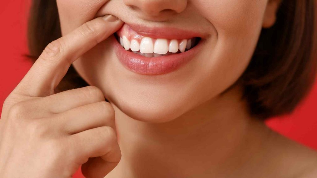 Masalah Gusi: Gejala, Penyebab, dan Cara Mengatasinya dengan Perawatan Dental yang Tepat