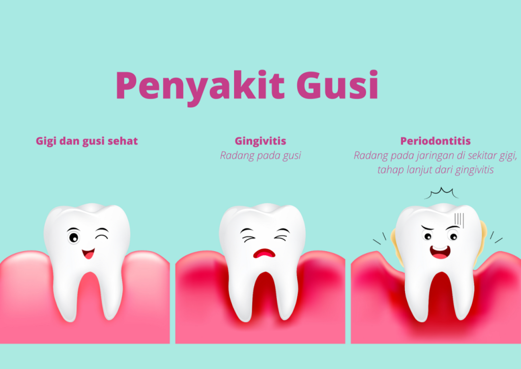 Pengaruh Diet terhadap Kesehatan Gigi dan Gusi